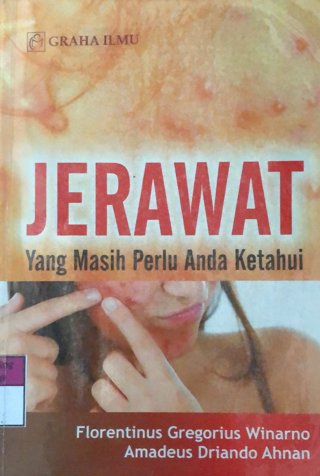 Sampul Jerawat :  Yang Masih Perlu Anda Ketahui / Florentinus Gregorius