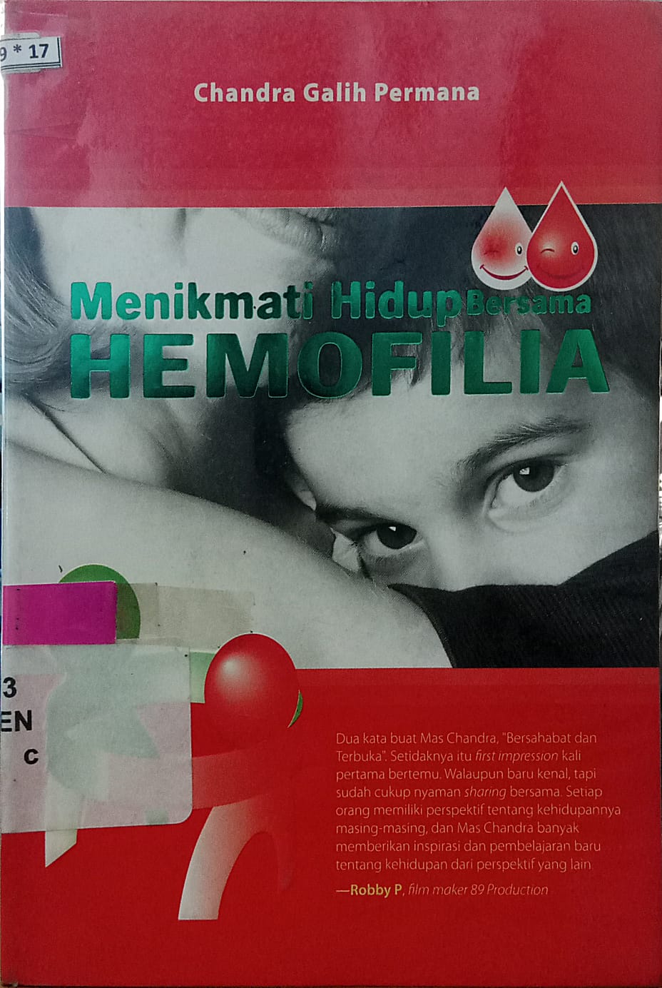Sampul Menikmati hidup bersama hemofilia / Chandra Galih Permana ; editor, Nurlaila