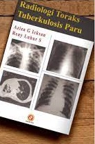 Cover Radiologi toraks tuberkulosis paru / Aziza G Icksan