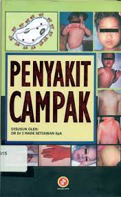 Sampul Penyakit Campak / DR Dr I Made Setiawan