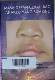 Sampul Masa depan cerah bagi anakku yang sumbing / Gentur Sudjatmiko